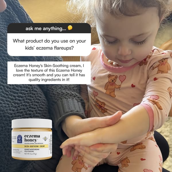 This ad features a photo of a young girl who has eczema. Her mother is asked what product she uses for her child's e