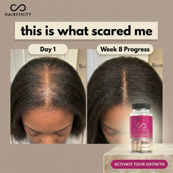 This image ad by Hairfinity uses a before and after comparison to showcase the effectiveness of their hair vitamins. The