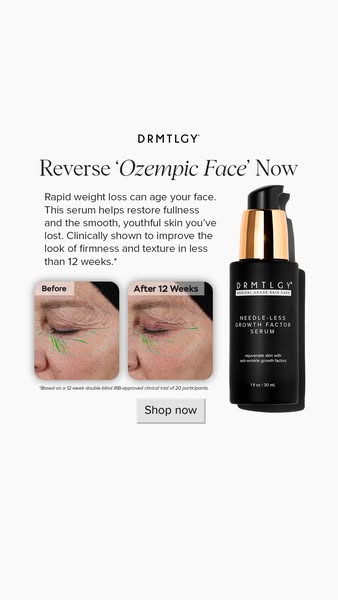 This image ad showcases DRMTLGY's Needle-less Growth Factor Serum, claiming it can reverse the effects of rapid weig