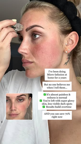 This ad showcases a woman using a micro-infusion tool. She then includes her testimonial and specific benefits to the pr