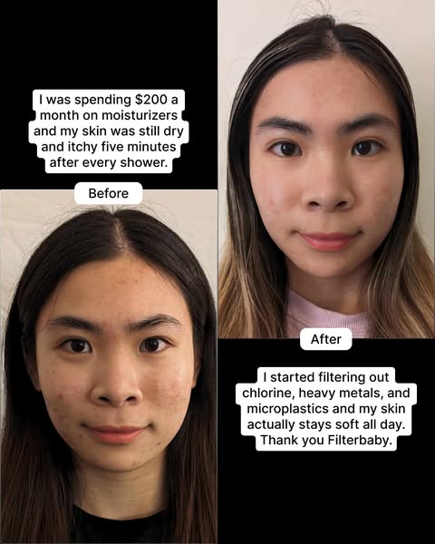 This ad for Filterbaby features a split-screen before-and-after format, highlighting the improvement in the customer'