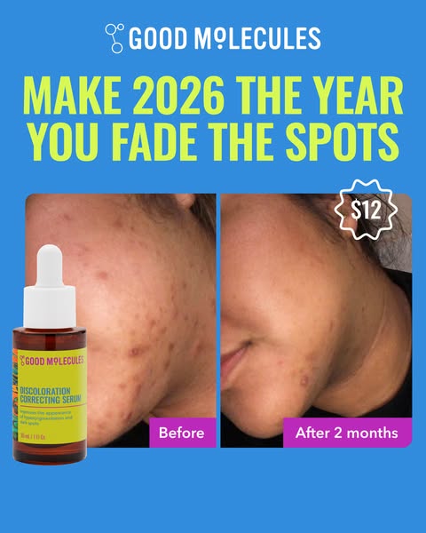 This image ad for Good Molecules Discoloration Correcting Serum shows a before and after photo of a woman's face wit