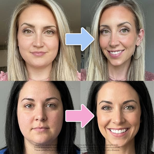 This ad shows before and after photos of two women, one blonde and one brunette, to demonstrate the effects of a product