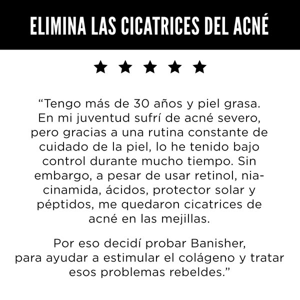 This ad features a testimonial from a woman over 30 with oily skin who suffered from severe acne in her youth. She state