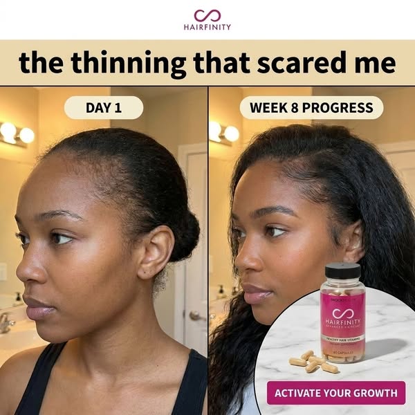 This ad shows the before and after effects of using Hairfinity Healthy Hair Vitamins. It targets people who are experien
