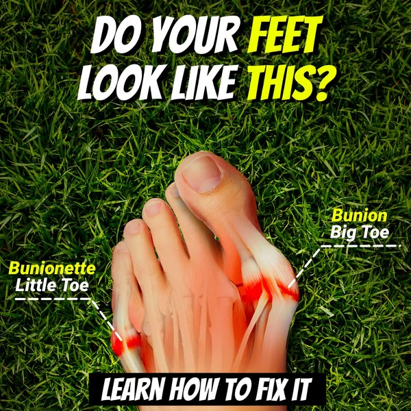 This image ad is designed to grab the viewer's attention by asking if their feet look like the foot shown in the ima