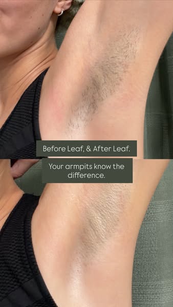 This image ad uses a before-and-after comparison to showcase the benefits of using Leaf to remove armpit hair. The ad ap