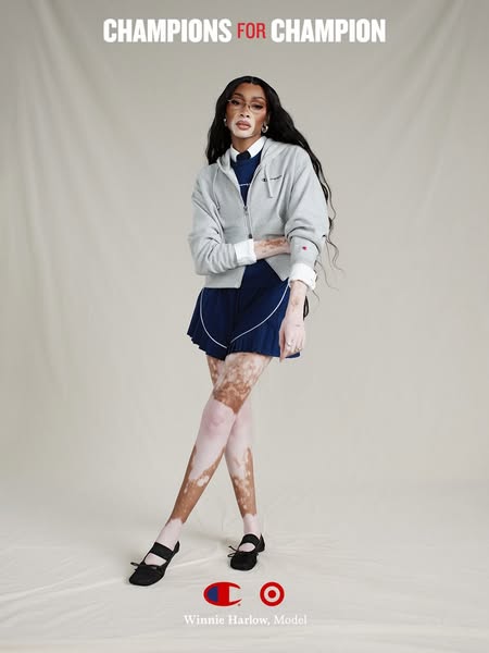 Winnie Harlow ad