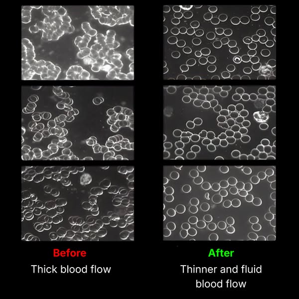 This image ad compares two microscopic photos of blood flow to advertise a product that helps with blood circulation. Th