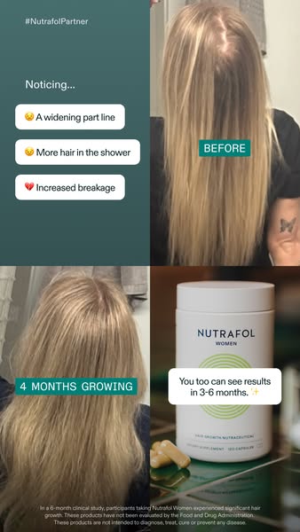 Nutrafol ad