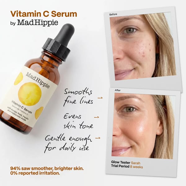 This ad for Mad Hippie Vitamin C Serum displays a before/after transformation on a woman’s face, alongside listed produc