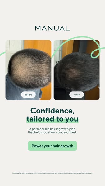This ad for Manual features a before and after image of a man's head, showing hair regrowth. The ad promises confide
