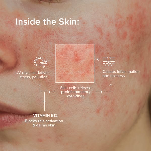This image ad features a close up of skin affected by inflammation and redness, along with information on what causes th