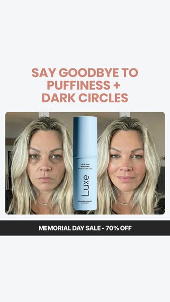 The ad is a before and after image of a woman's face. On the left, she has dark circles and puffiness under her eyes