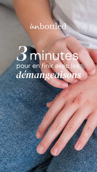 This ad shows a close up shot of a person's hand that has red irritated skin. The ad's text promises to relieve 