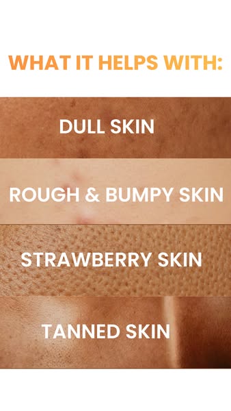 An image ad calling out different skin conditions the product helps with.