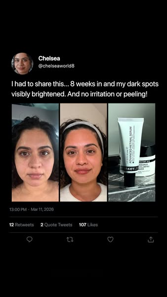 This ad features a social media post in which a woman named Chelsea shares her positive experience using an Advanced Ret