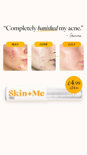 Skin + Me ad