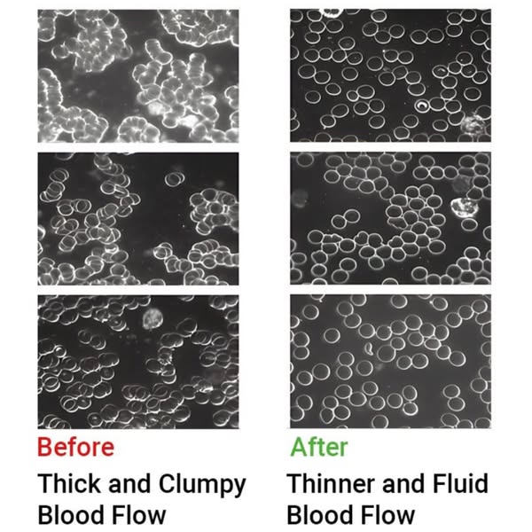 This ad uses before and after images of blood flow to highlight the product's benefit of making blood flow thinner a