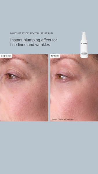 This ad utilizes a before and after photo of a woman's face to show the effectiveness of the ALPHA-H Multi-Peptide R