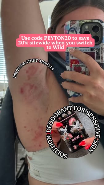 littleherculette ad