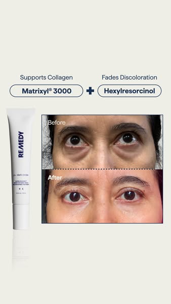 Remedy Science ad