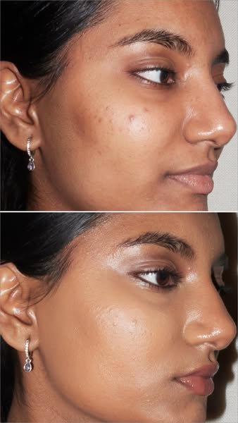 This ad shows a before and after photo of a woman's face, presumably to demonstrate the effectiveness of a skincare 