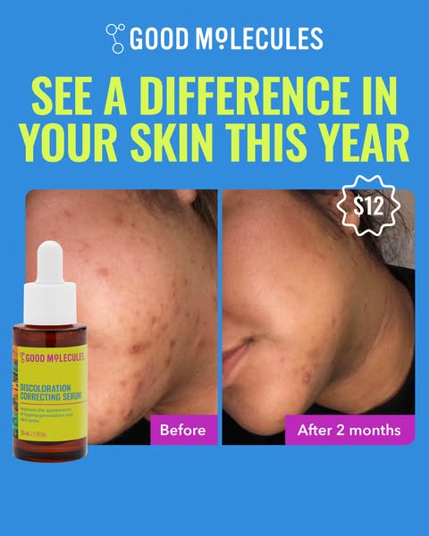 This image ad for Good Molecules Discoloration Correcting Serum uses a before and after format to showcase the product&#