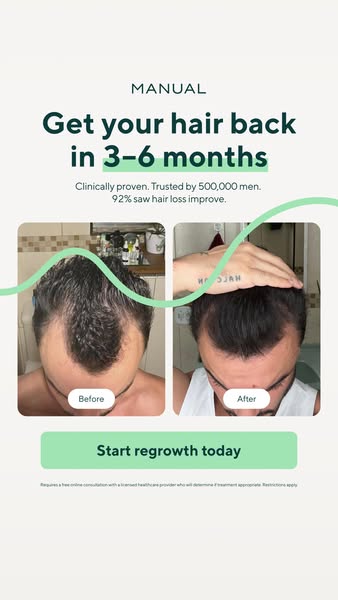 The ad shows the before and after photos of a man with hair loss who used the product. The ad mentions the product is cl