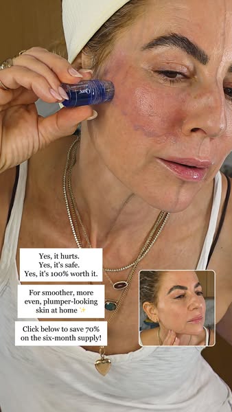 Dewy Faced B ad