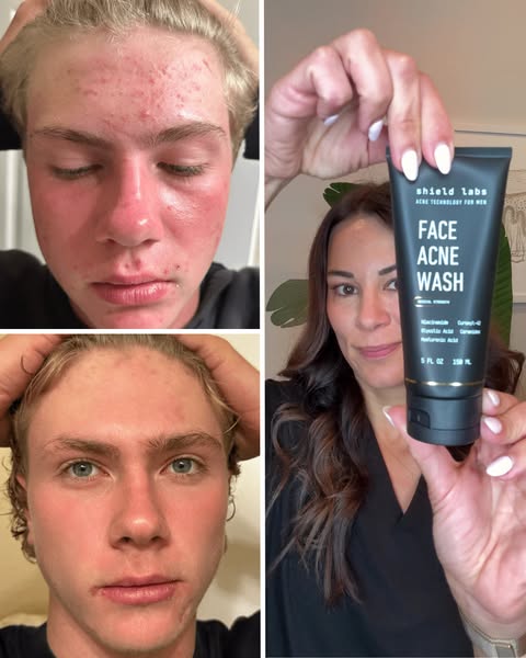 Dermguru ad