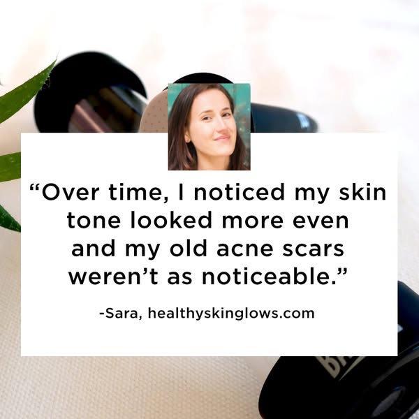 This ad features a testimonial from a customer who experienced positive results using the advertised skincare product, s