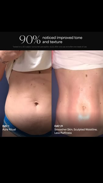 Before and after image showing skin results from Aura Ritual.