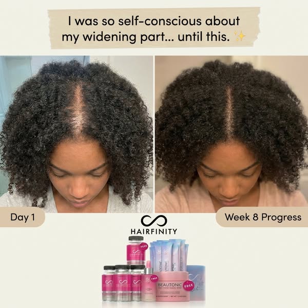 This image ad uses a before-and-after comparison to showcase the results of Hairfinity products on a woman's hair. T