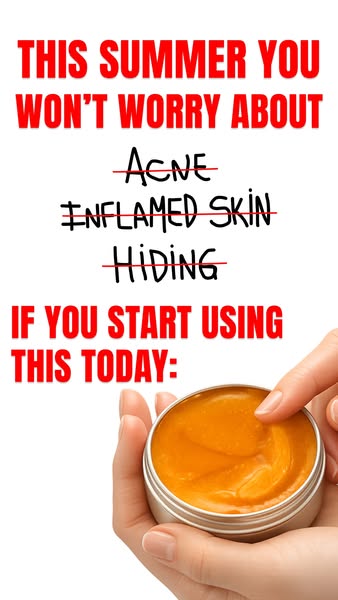 The ad highlights the promise of a worry-free summer by using a product to help with acne, inflammation and hiding.