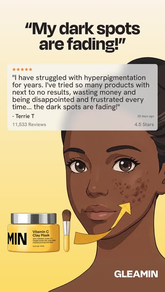 This ad features a testimonial from a customer who has struggled with hyperpigmentation and has found the Gleamin Vitami