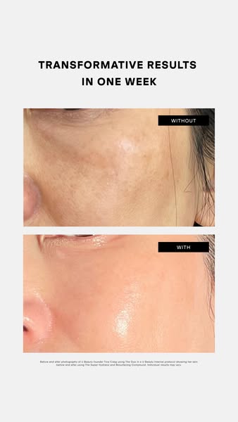 This ad shows the before and after results of using a skincare product for one week.