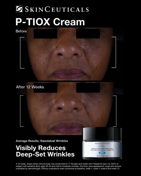 This image ad for SkinCeuticals P-TIOX Cream showcases the product's effectiveness in visibly reducing deep-set wrin