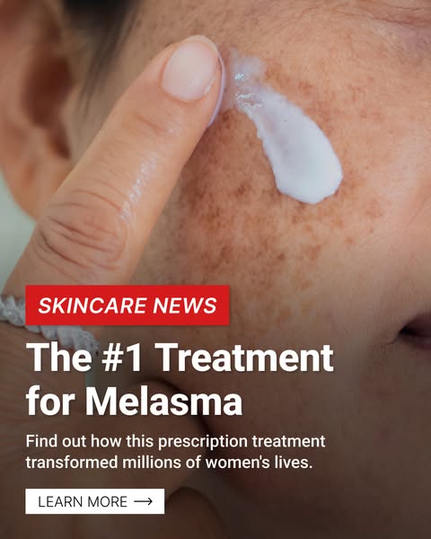 This image ad is advertising the #1 treatment for melasma. The ad shows a close up of a face with melasma and a finger w