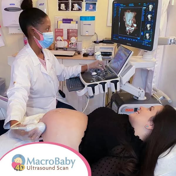 macrobaby ad