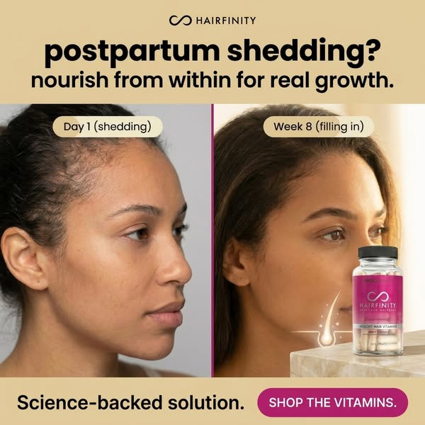 This image ad for Hairfinity vitamins targets new mothers experiencing postpartum hair shedding. It features a split-scr