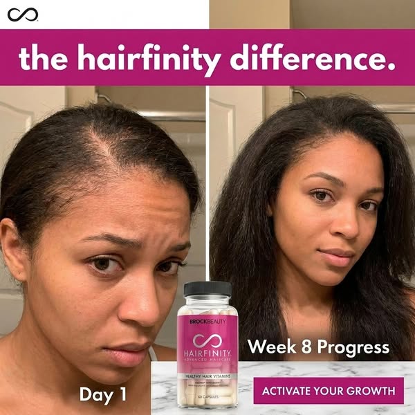 This image ad features a side-by-side before-and-after shot of a woman's hair, with the Hairfinity product shown in 