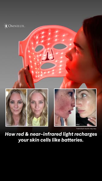 This image ad for Omnilux features a woman holding the red light therapy mask to her face. The ad also includes before a