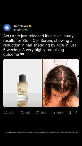 ActandAcre ad