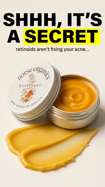 This ad is promoting a pimple stopper day balm from Norse Organics, suggesting it's better than other acne treatment