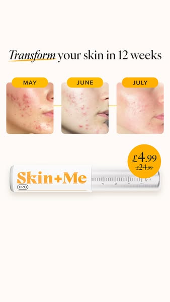 This ad shows before and after photos of a woman's face over a 12-week period of using the Skin+Me product, highligh