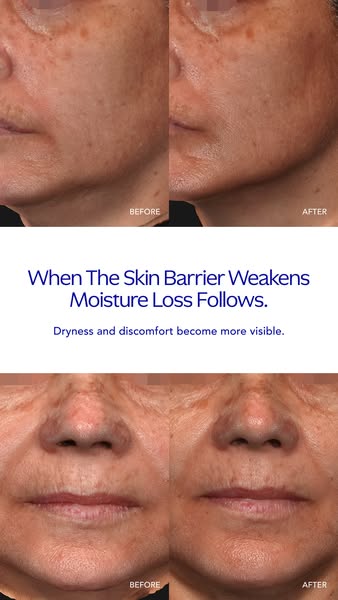 This ad uses a before and after format to show the effects of a product on the skin. The ad claims that when the skin ba