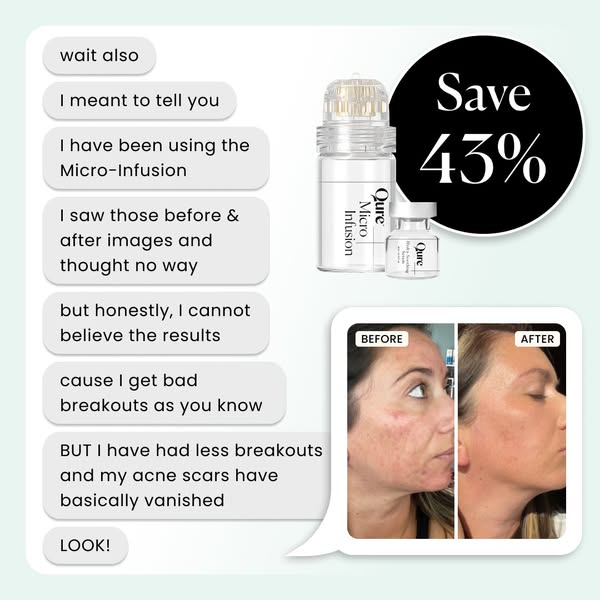 This ad for Qure skin care features a customer testimonial in the style of a text message conversation. The customer sha
