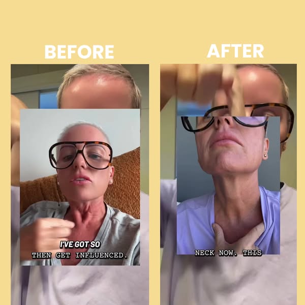 An ad featuring a before and after of a woman's neck and chest area. The ad promotes a product for skincare.
