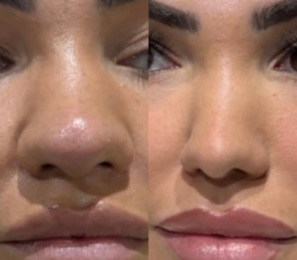 Dr Katya Beauty - LDN ad